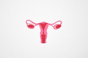 Pros and Cons of Keeping Ovaries With Hysterectomy